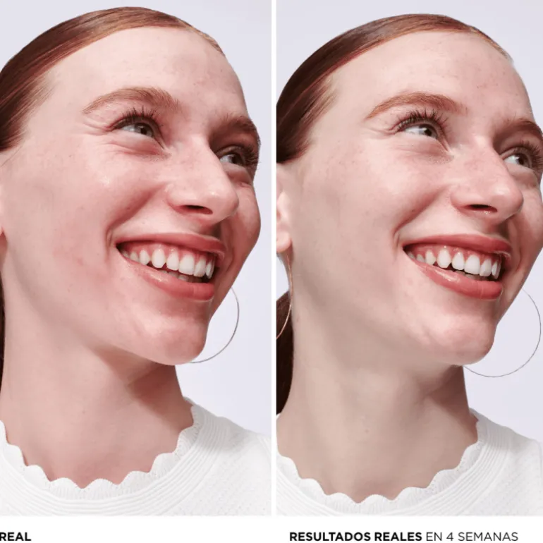 BYE BYE REDNESS SERUM