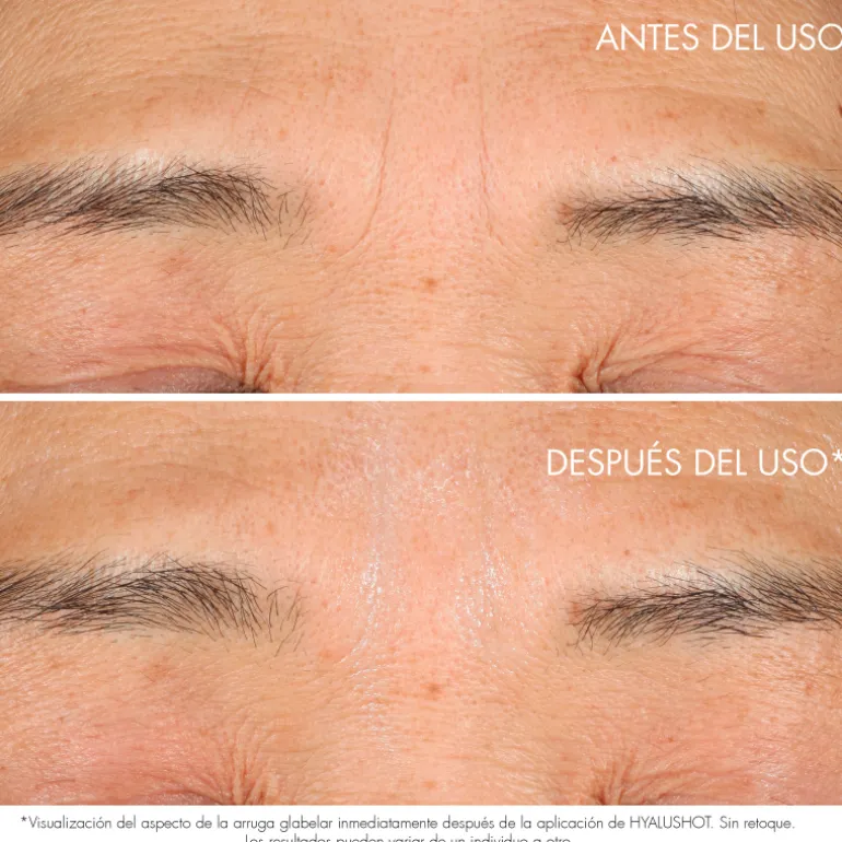 CAPTURE TOTAL HYALUSHOTCorrector de arrugas existentes y primeros signos de arrugas
