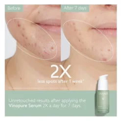 Set Sérum Vimopure  + Vinopure Stop Granos  Regalo