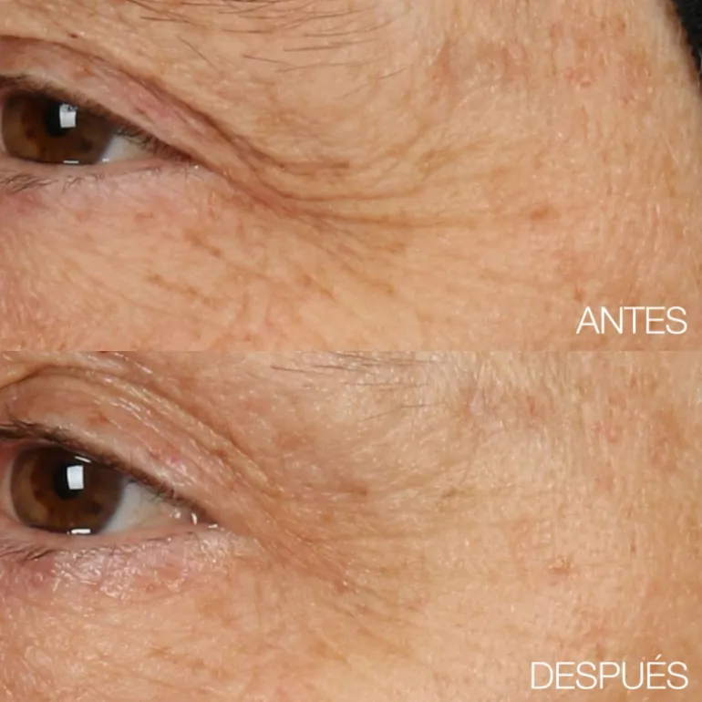 Smart Clinical Repair Crema de Recuperación Nocturna y Mascarilla