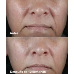 SMART CLINICAL REPAIR WRINKLE CORRECTING RICH CREAM 50ML