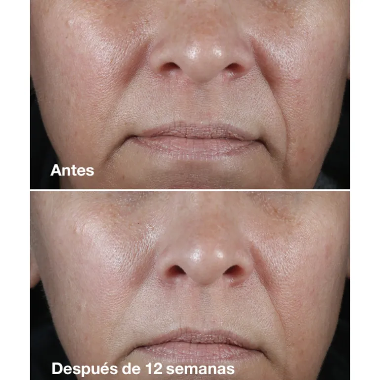 SMART CLINICAL REPAIR WRINKLE CORRECTING RICH CREAM 50ML