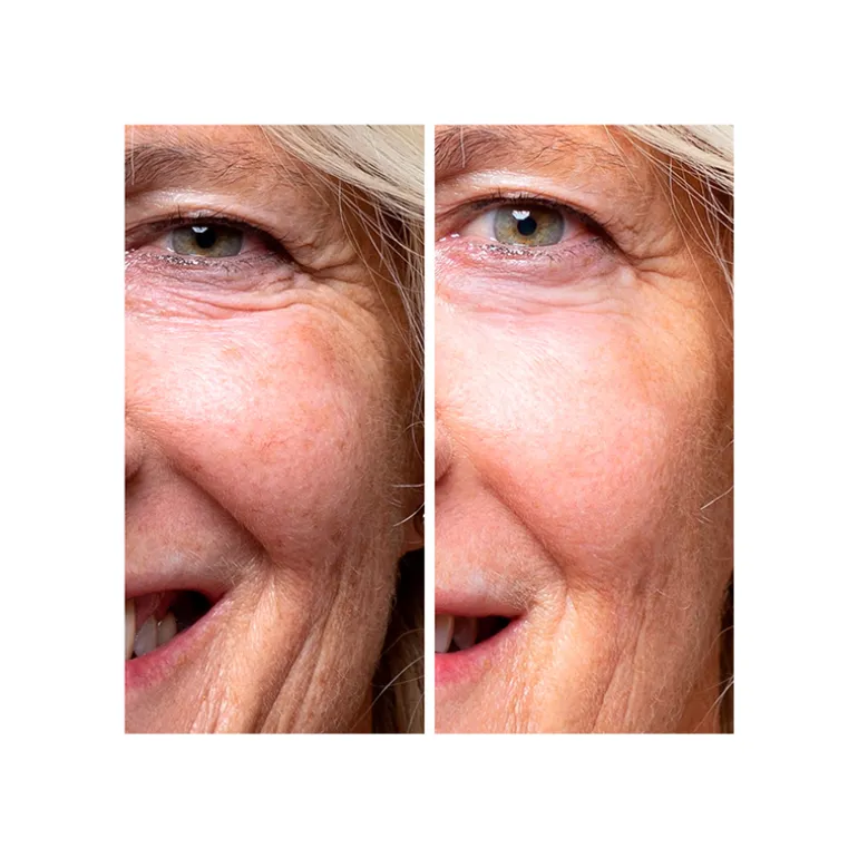 The Cure con Bakuchiol